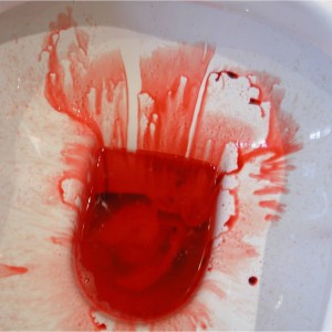 Blood in toilet